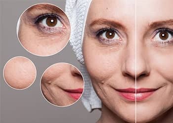 age spots treatment procedure