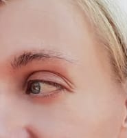 pdo threads treatment after