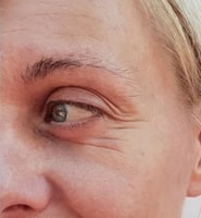 pdo threads treatment before