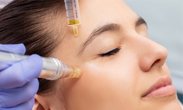 prp treatment for face in lahore